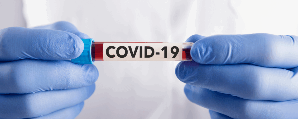 How Cloud ERP Helps To Drive Your Business In The Battle Of COVID 19